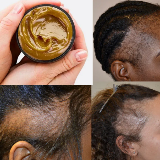 Huile Capillaire Régénérante de Cheveux - NutriHair™