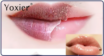 Sérum éclaircissant pour lèvres Yoxier™